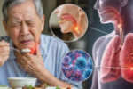 3 bệnh thường gặp ở người cao tuổi khi giao mùa